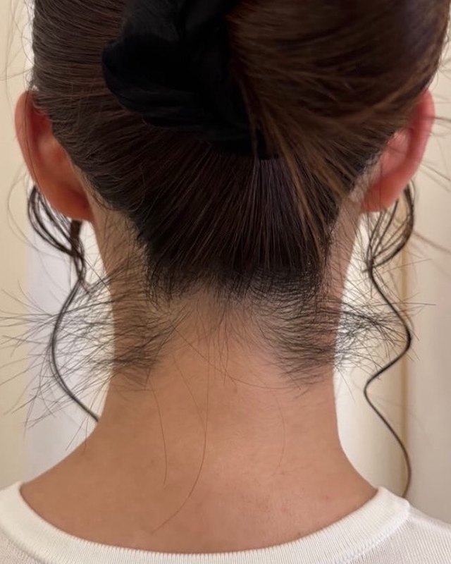 うなじワックス脱毛前のうなじ